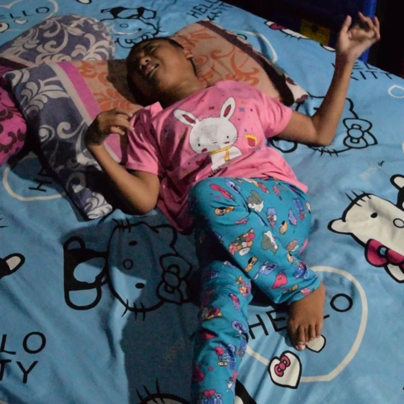 Ayo Bantu Dek Nurry Penderita Cerebral Palsy