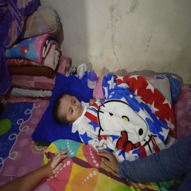 Seorang Janda di Garut,harus Rawat Anak Hydrosefalus sendirian