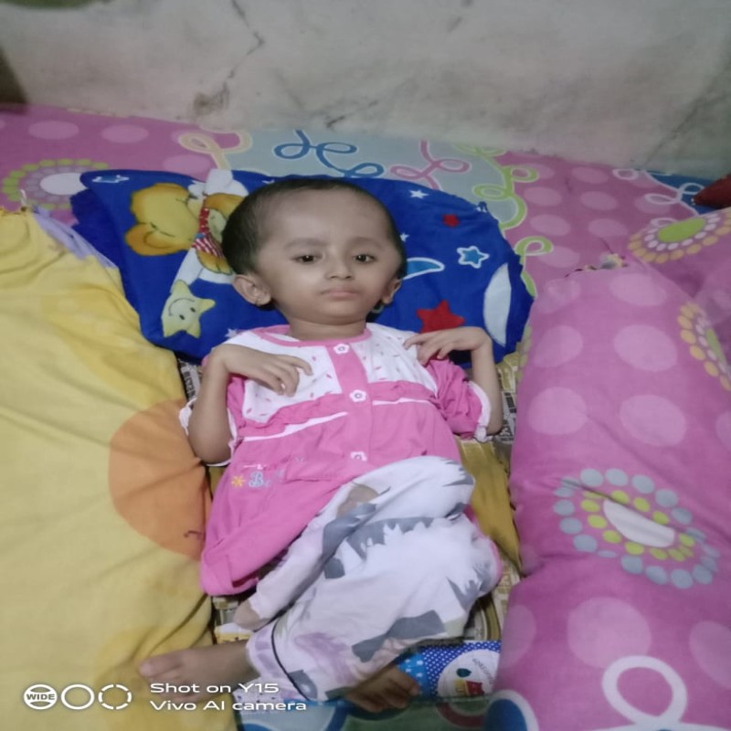 Seorang Janda di Garut,harus Rawat Anak Hydrosefalus sendirian