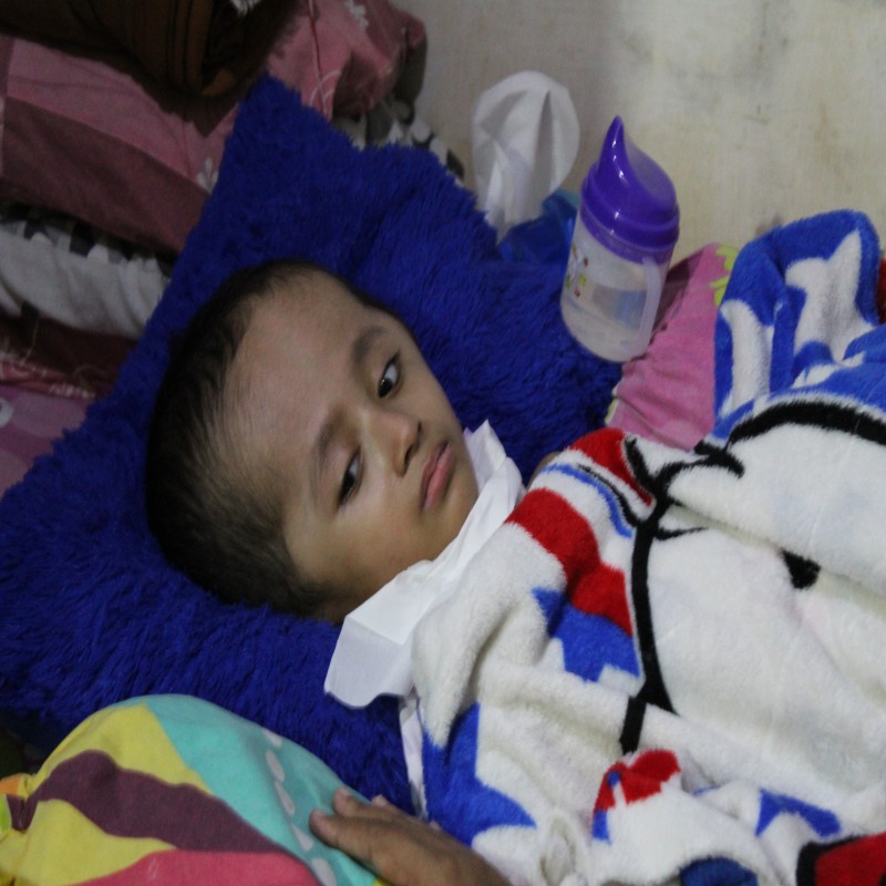 Seorang Janda di Garut,harus Rawat Anak Hydrosefalus sendirian