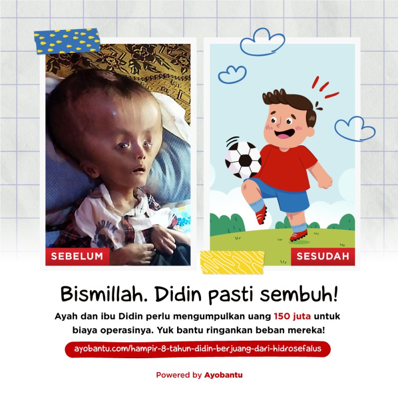 Hampir 8 tahun! Didin berjuang dari Hidrosefalus