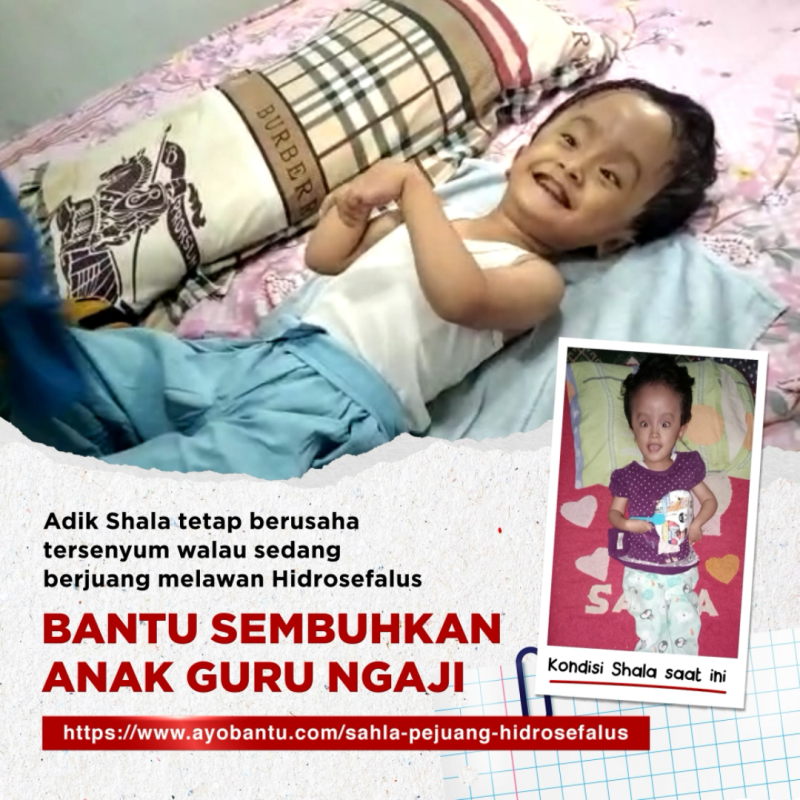 Bantu Perjuangan Seorang Guru Untuk Pengobatan Putrinya Yang Sakit Hidrosefalus