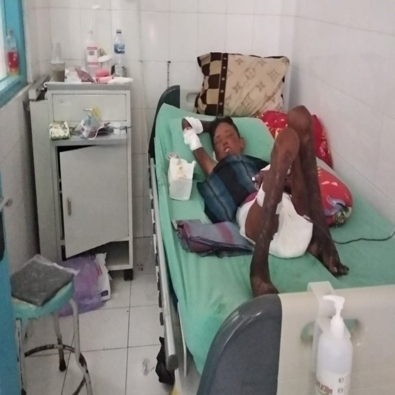 #BantuFildasari Sembuh dari Lepra