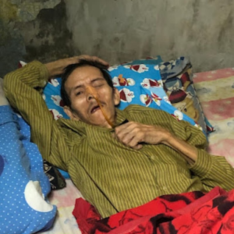Bantu Pak Unu Melawan Pembekuan Otak dan TB Paru