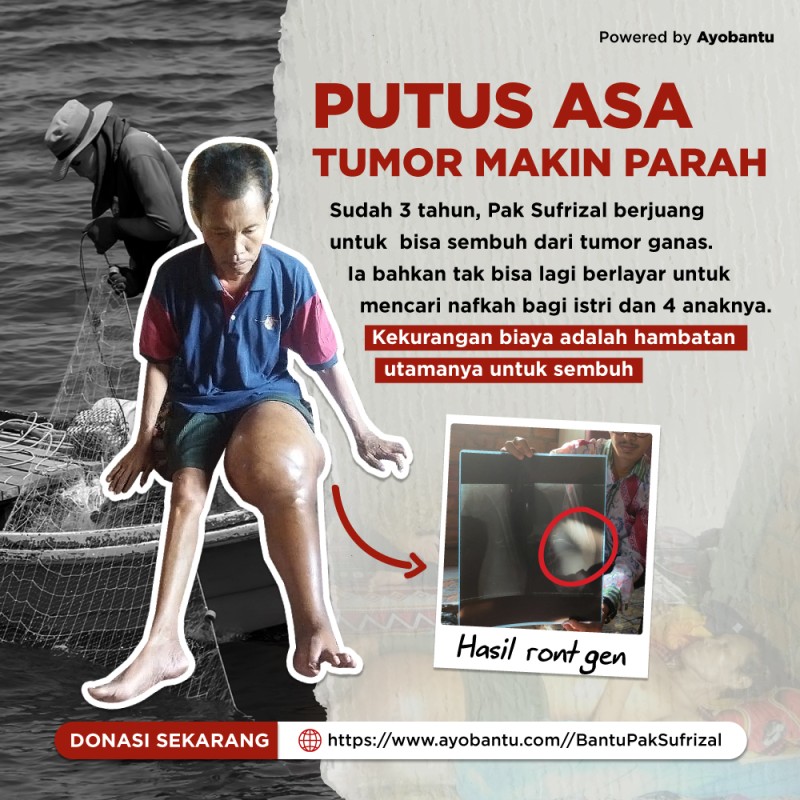 Beri Kesembuhan pada Pak Sufrizal, Nelayan yang Menderita Tumor Ganas