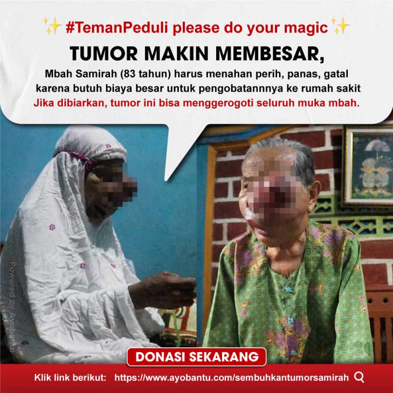 Sembuhkan Mbah Samirah dari Tumor Ganas