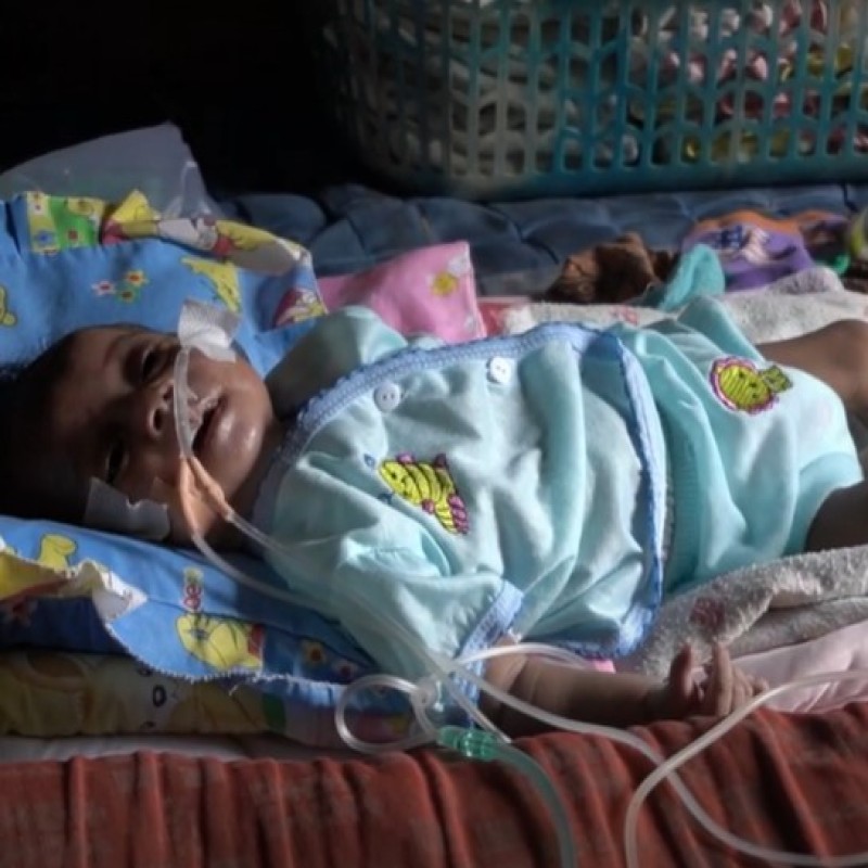 Bantu Fadila Sembuh dari Peradangan Paru-Paru