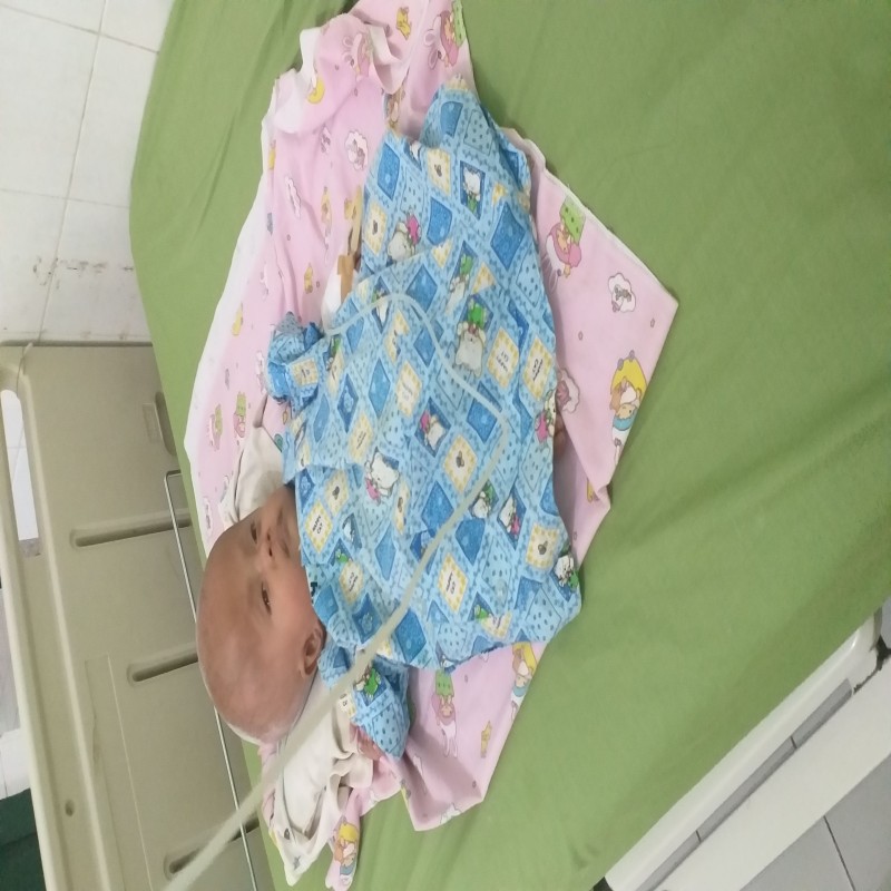 Selamatkan unna dari hidrpsefalus dan kejang kejang