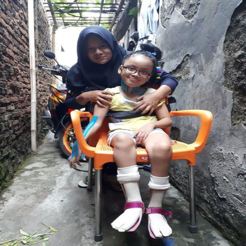 Bantu Kirana untuk sembuh dari lumpuh otak