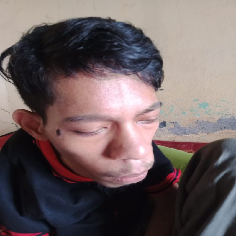RIDWAN, DIFABEL CEREBRAL PALCY PENGIDAP CARDIOMEGALI BUTUH BIAYA PENGOBATAN