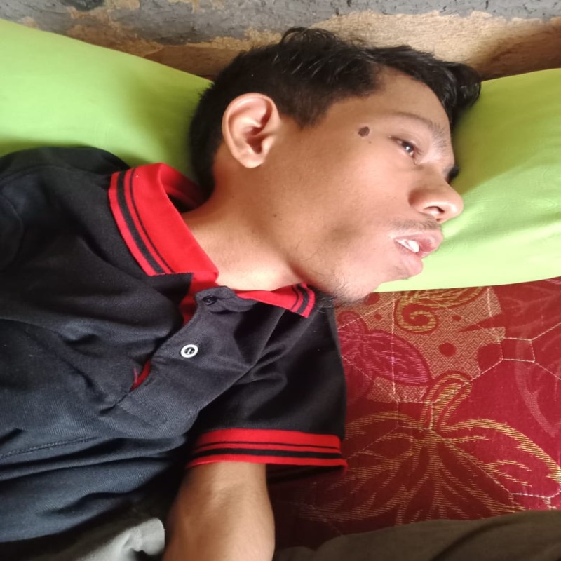RIDWAN, DIFABEL CEREBRAL PALCY PENGIDAP CARDIOMEGALI BUTUH BIAYA PENGOBATAN
