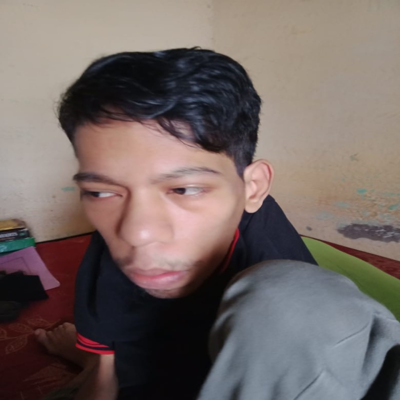 RIDWAN, DIFABEL CEREBRAL PALCY PENGIDAP CARDIOMEGALI BUTUH BIAYA PENGOBATAN