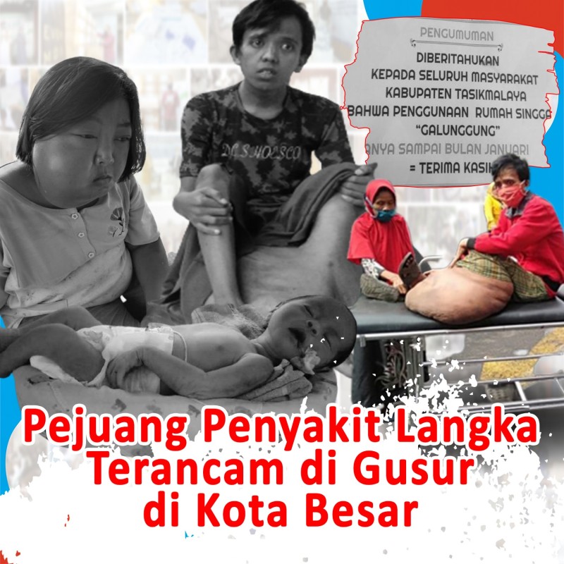 Ratusan pejuang penyakit langka dari pelosok terancam Terlantar di Kota besar