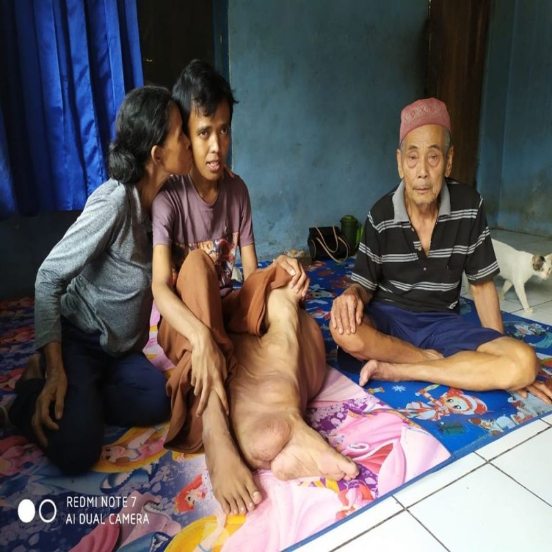 Ratusan pejuang penyakit langka dari pelosok terancam Terlantar di Kota besar