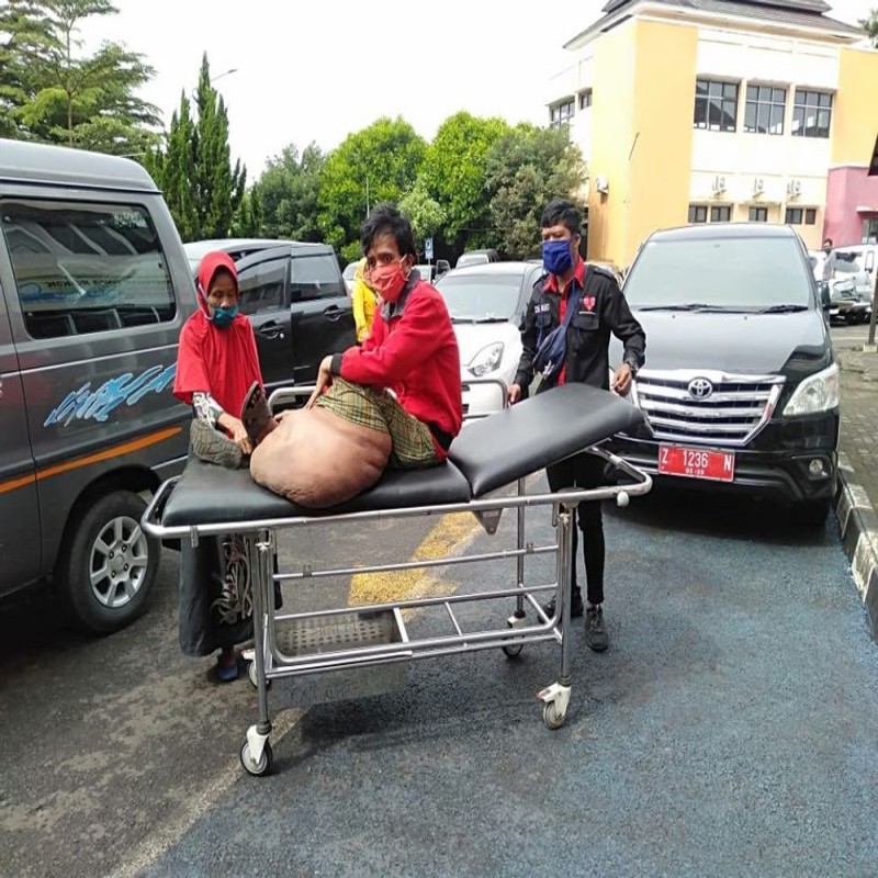 Ratusan pejuang penyakit langka dari pelosok terancam Terlantar di Kota besar