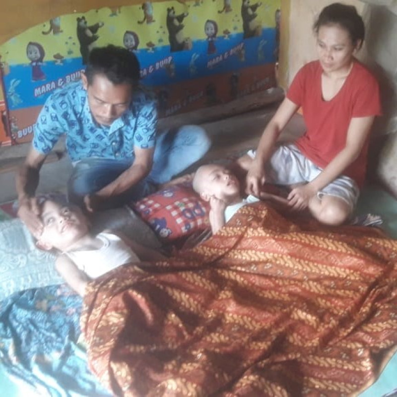 Mengidap Hidrosefalus, Bantu Davin Sembuh