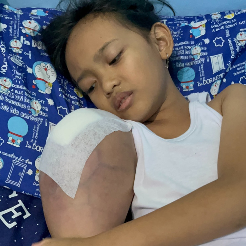 Bantu Selamatkan Siska Dari Kanker Tulang
