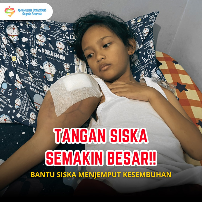 Bantu Selamatkan Siska Dari Kanker Tulang