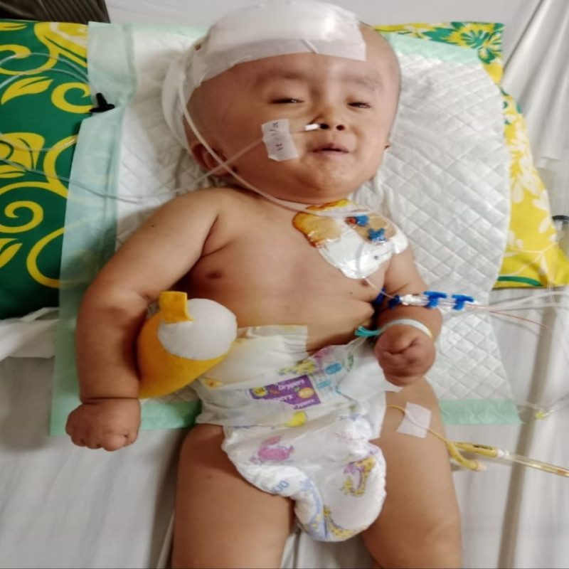 Hidrosefalus Epilepsi dan Spinabifida 3 Penyakit Sekaligus Menyerang Fariz!!
