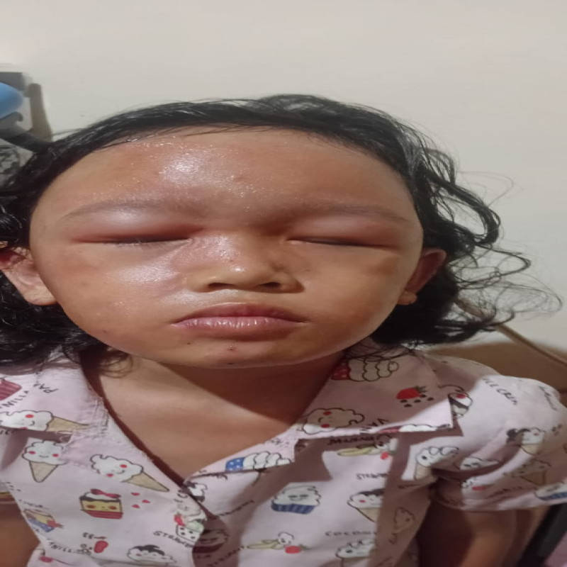Bersama Kita Sembuhkan Mereka