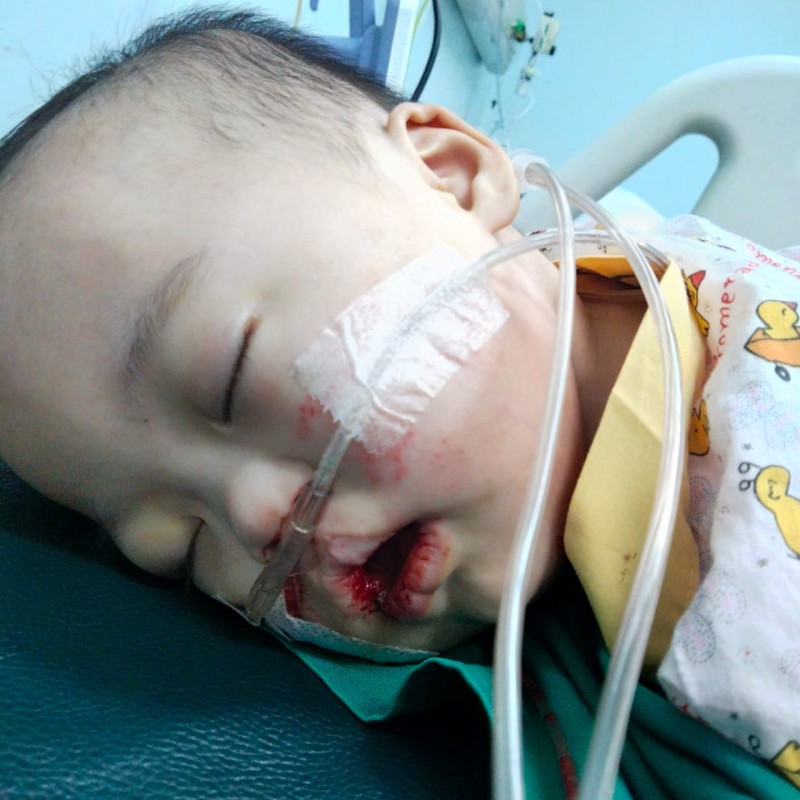 Bayi 1 Tahun Menderita Berbagai Penyakit Dalam Tubuh Mungilnya