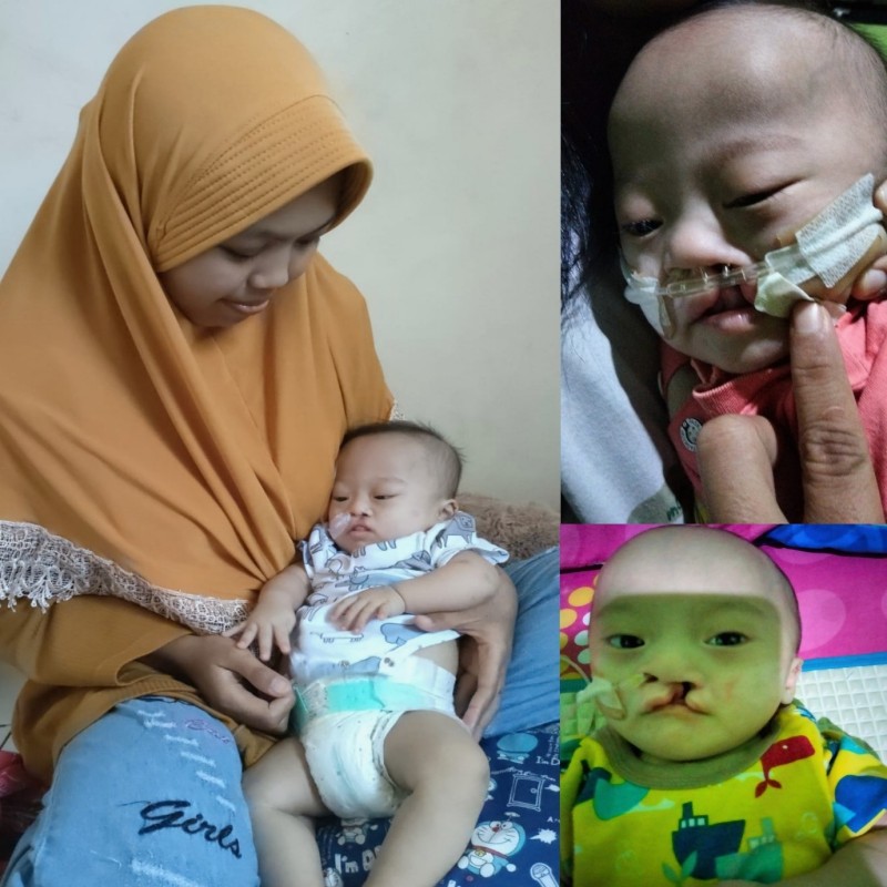 Bayi 1 Tahun Menderita Berbagai Penyakit Dalam Tubuh Mungilnya