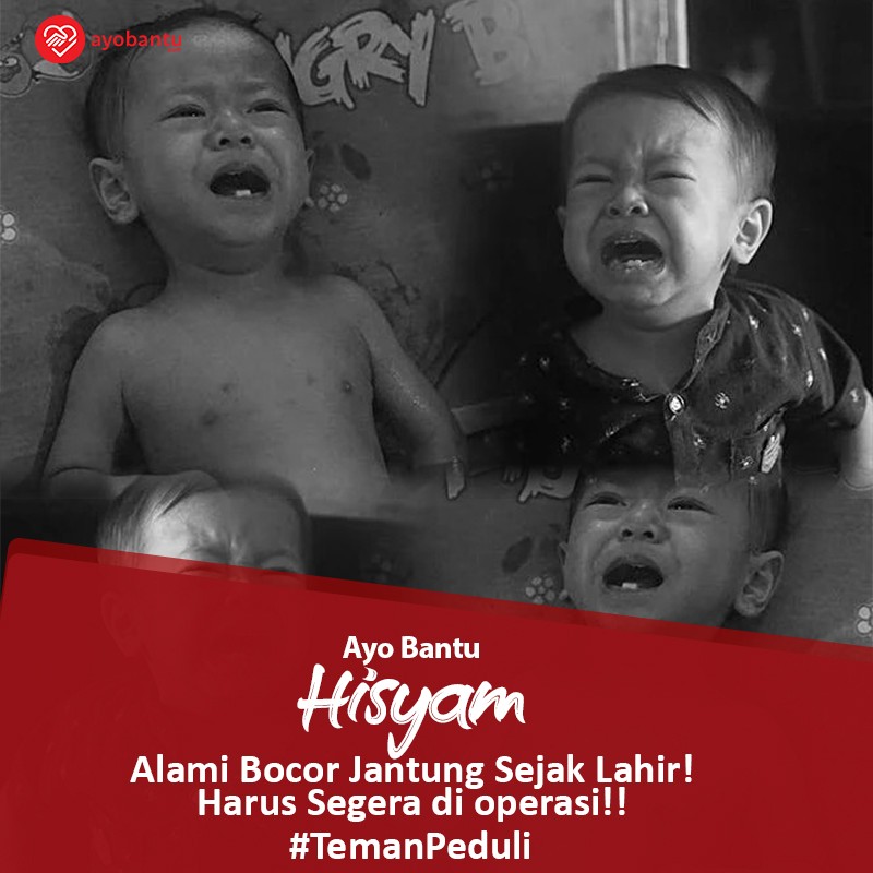 Bantu Hisyam (12Bulan) Derita Bocor Jantung Sejak Lahir