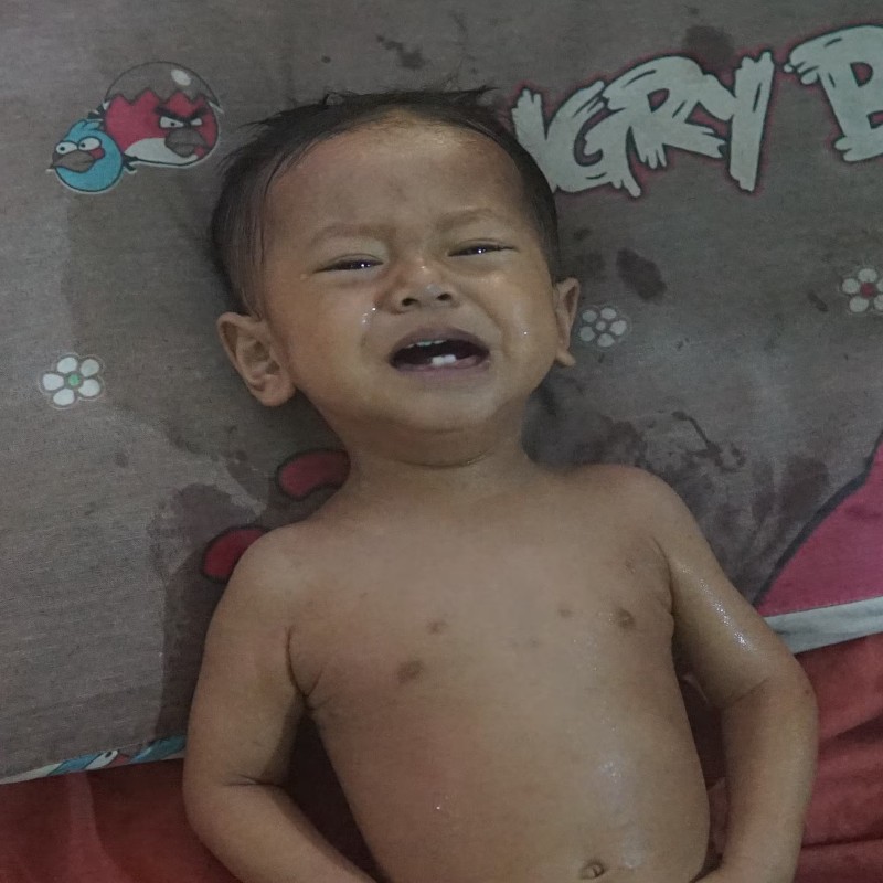 Bantu Hisyam (12Bulan) Derita Bocor Jantung Sejak Lahir