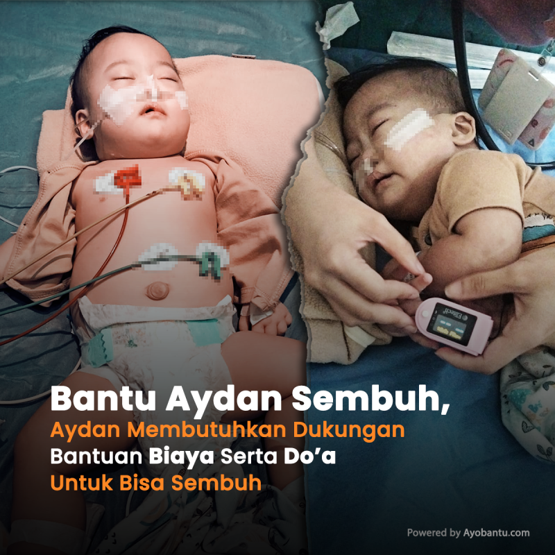 Bayi 1 Tahun Menderita Berbagai Penyakit, Tolong Aydan Untuk Bisa Terus Berobat