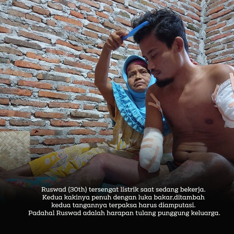 Tulang Pungggung Keluarga Kehilangan Kudua Tangannya, Dukunganmu Bantu Ruswad Bahahagiakan Orangtua