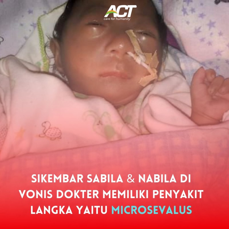 Bantu Sikembar Mini Sabila & Nabila Berobat