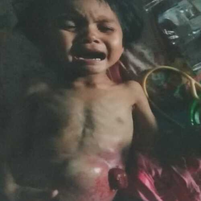 Urgent! Bantu Dek Nia Untuk Sembuh Dari Penyakit Usus Langka