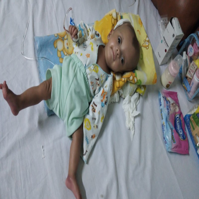 Terserang Hidrosefalus, adik Aisyah Harus Segera Operasi