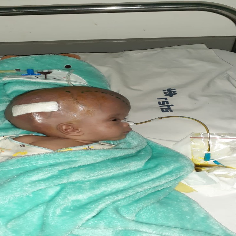 Terserang Hidrosefalus, adik Aisyah Harus Segera Operasi