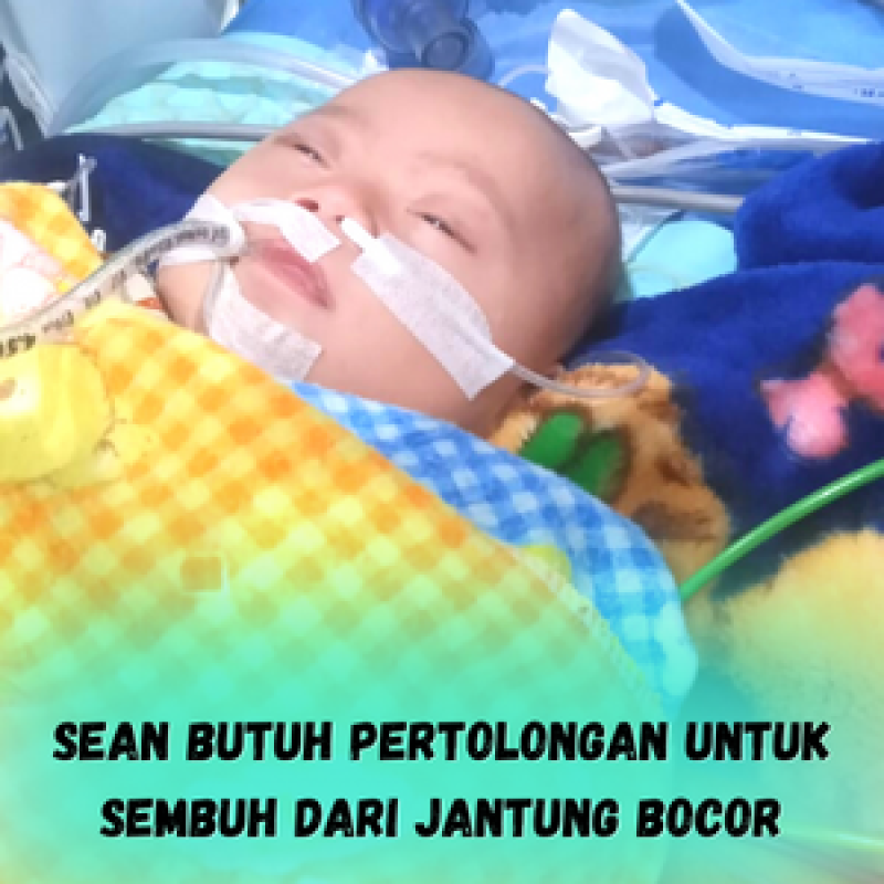 Sean (7 bulan) Butuh Pertolongan Untuk Sembuh Dari Jantung Bocor