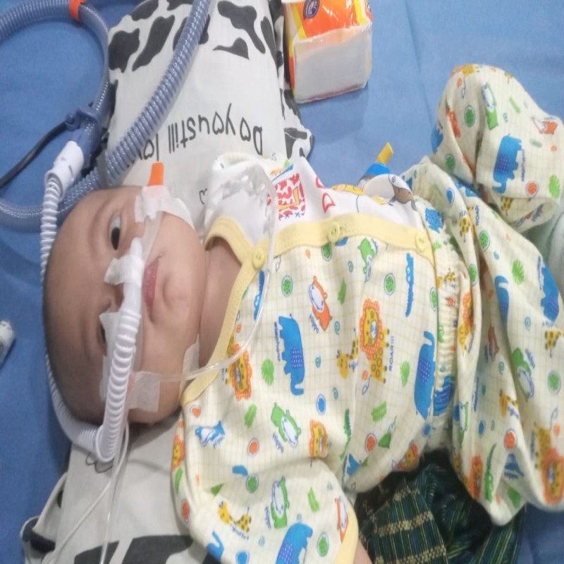 Sean (7 bulan) Butuh Pertolongan Untuk Sembuh Dari Jantung Bocor