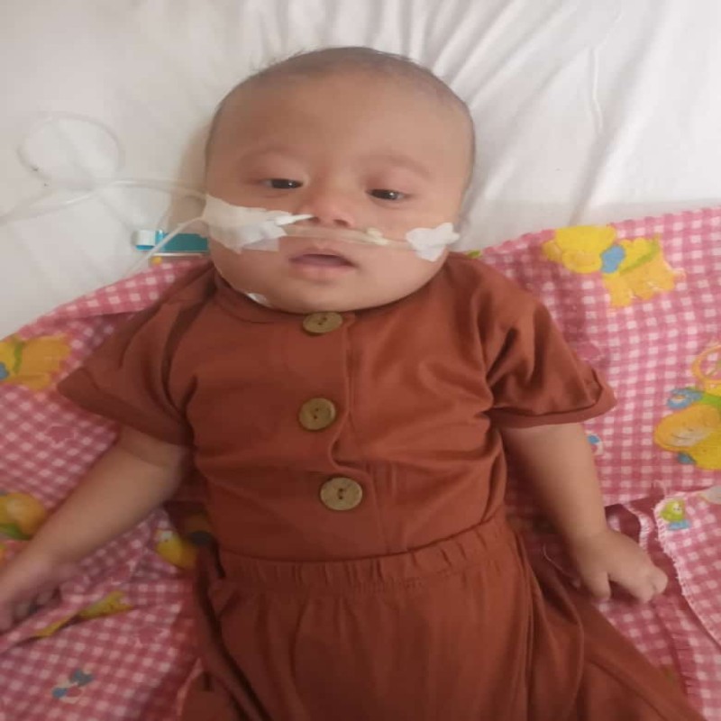 Sean (7 bulan) Butuh Pertolongan Untuk Sembuh Dari Jantung Bocor