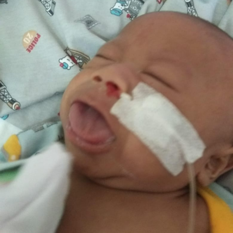 Mengidap syndrome langka di dunia, Tolong ilham untuk sembuh
