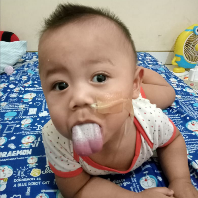 Mengidap syndrome langka di dunia, Tolong ilham untuk sembuh