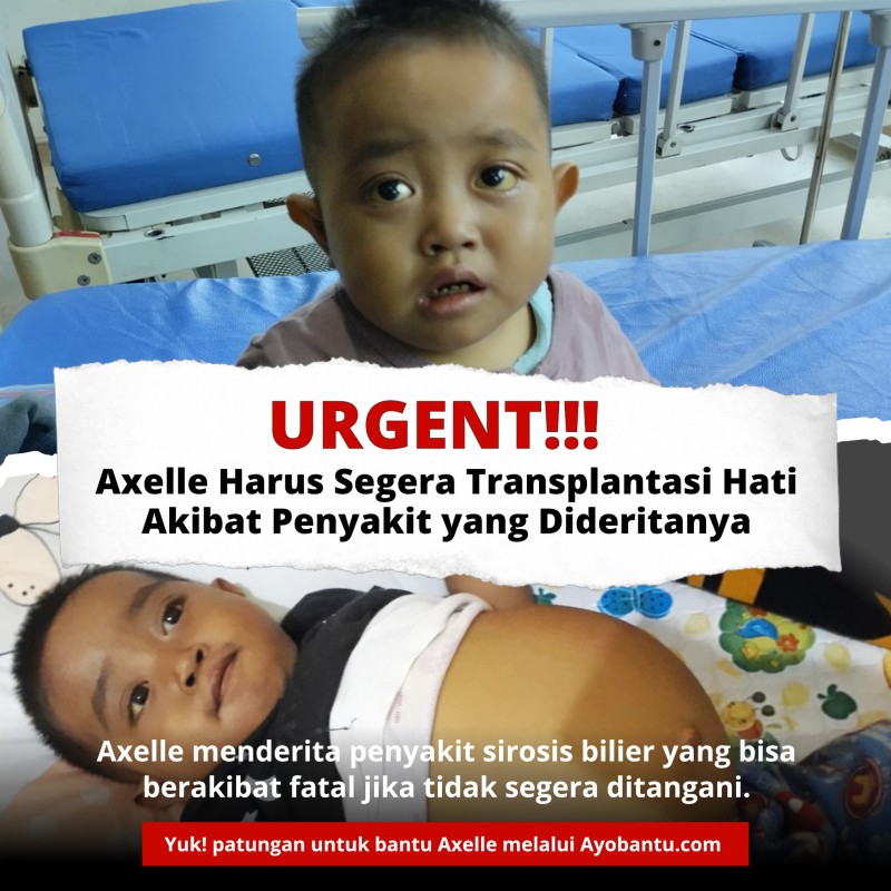 Sirosis Bilier Mengancam Nyawa Axelle