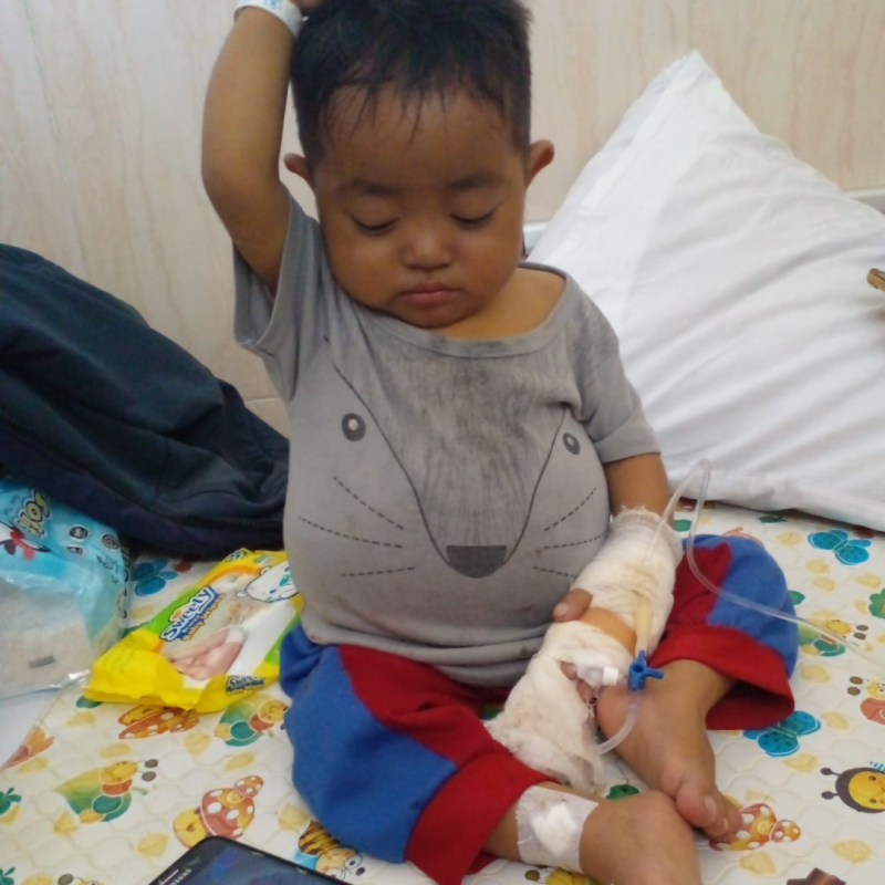 Sirosis Bilier Mengancam Nyawa Axelle