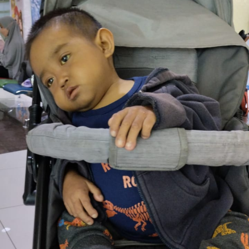 Sirosis Bilier Mengancam Nyawa Axelle