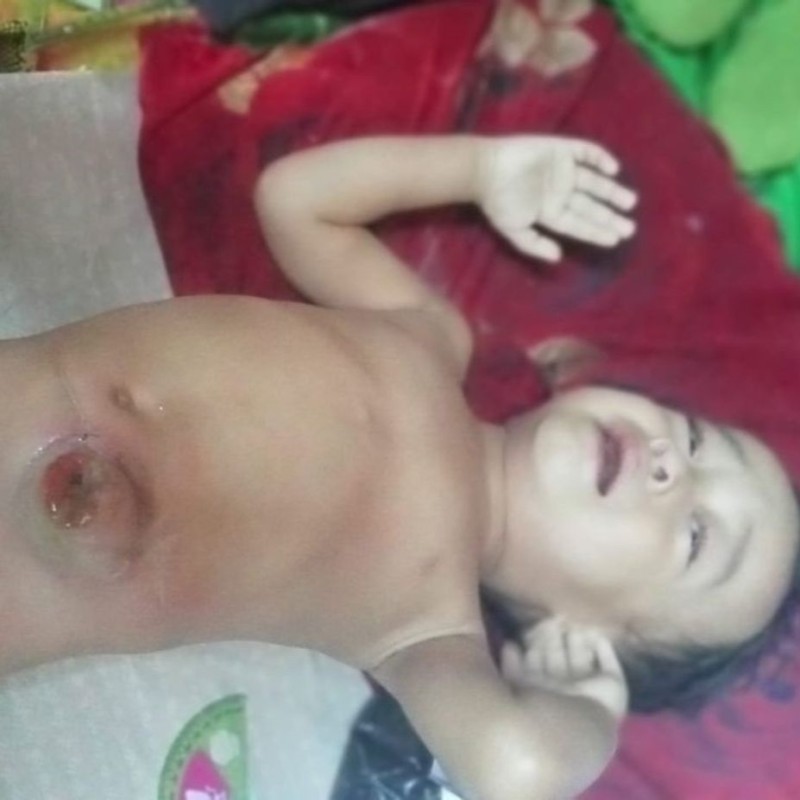 Ayah Tak Kembali, Abir Tahan Sakit Gagal Dioperasi