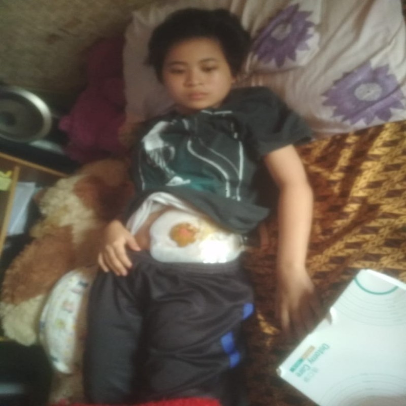 Beri Harapan Hidup untuk Witarsih Sembuh dari TB Usus, Butuh Penanganan Segera!