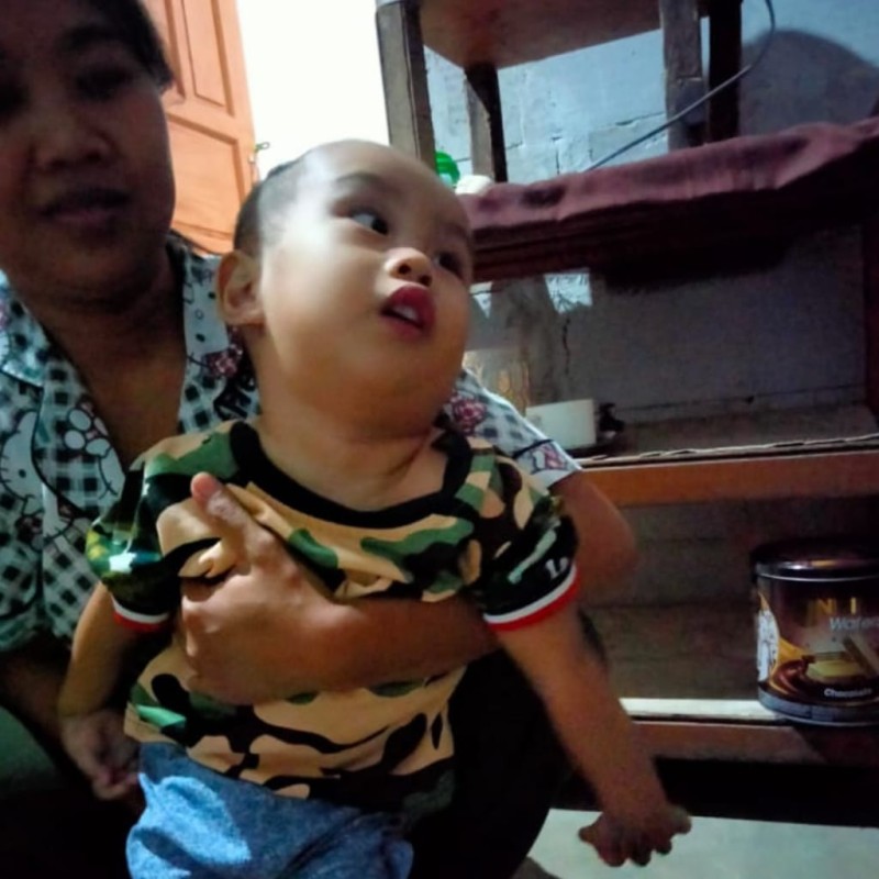 Ayah Gangguan Jiwa, Alvin Kesakitan Menahan Polio yang Dideritanya