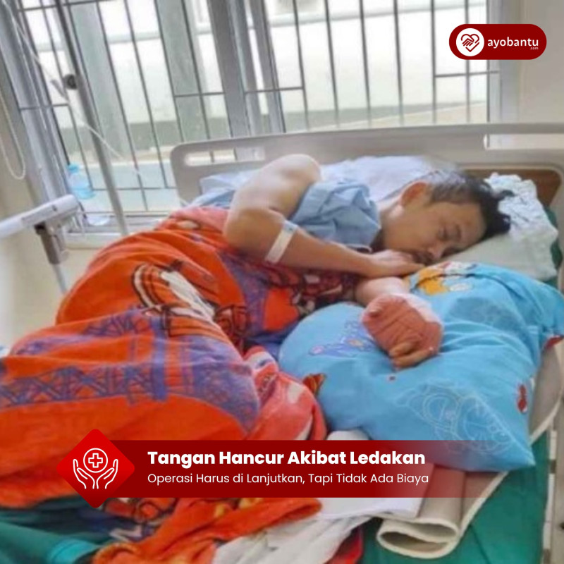 Tangan Hancur Akibat Ledakan, Operasi Tertunda Karena Tunggakan RS