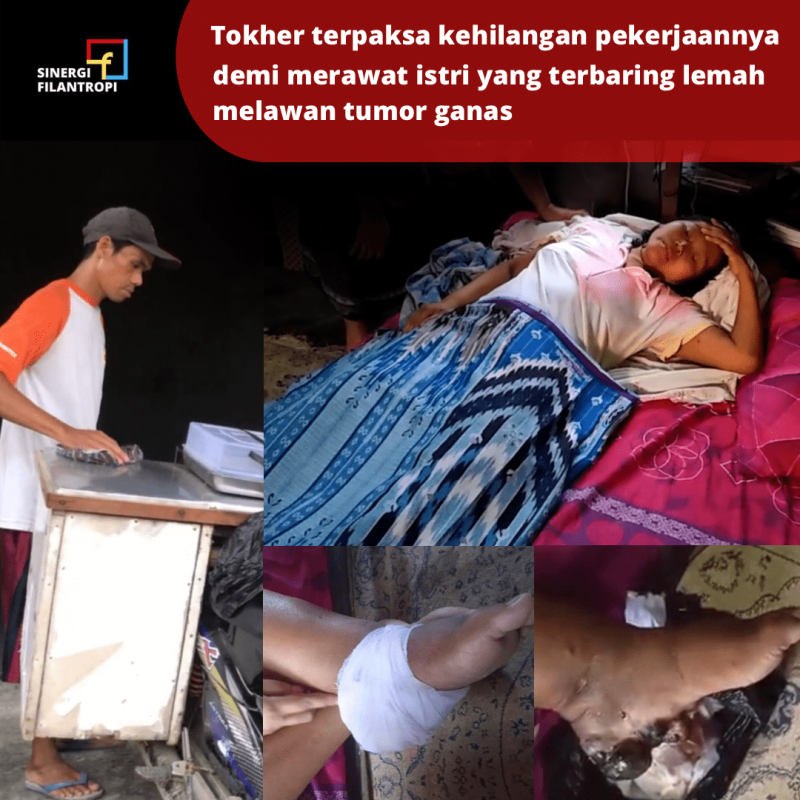 Mari Bantu Siti Lawan Tumor Ganas