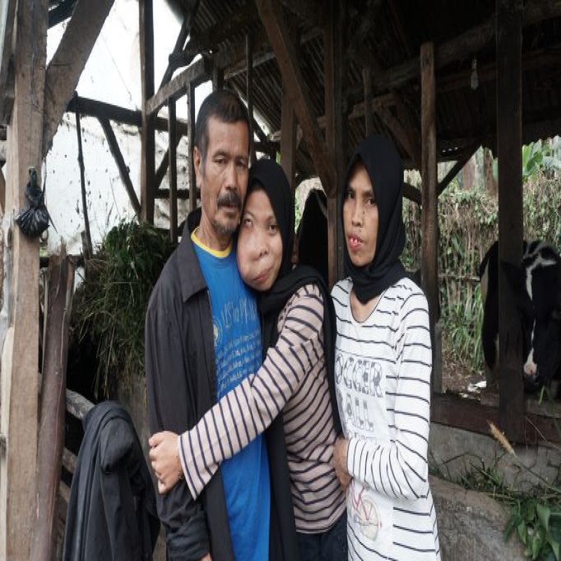 Tumor, sembuhlah.. Mutiara ingin wajahnya kembali normal