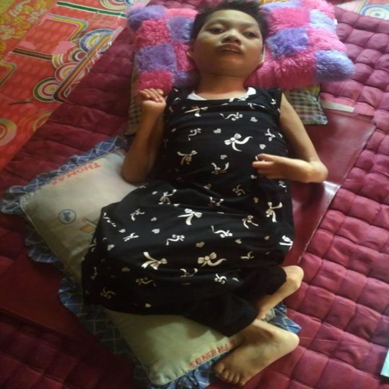 BANTU TASHA GADIS 18 TAHUN YANG CACAT DARI LAHIR
