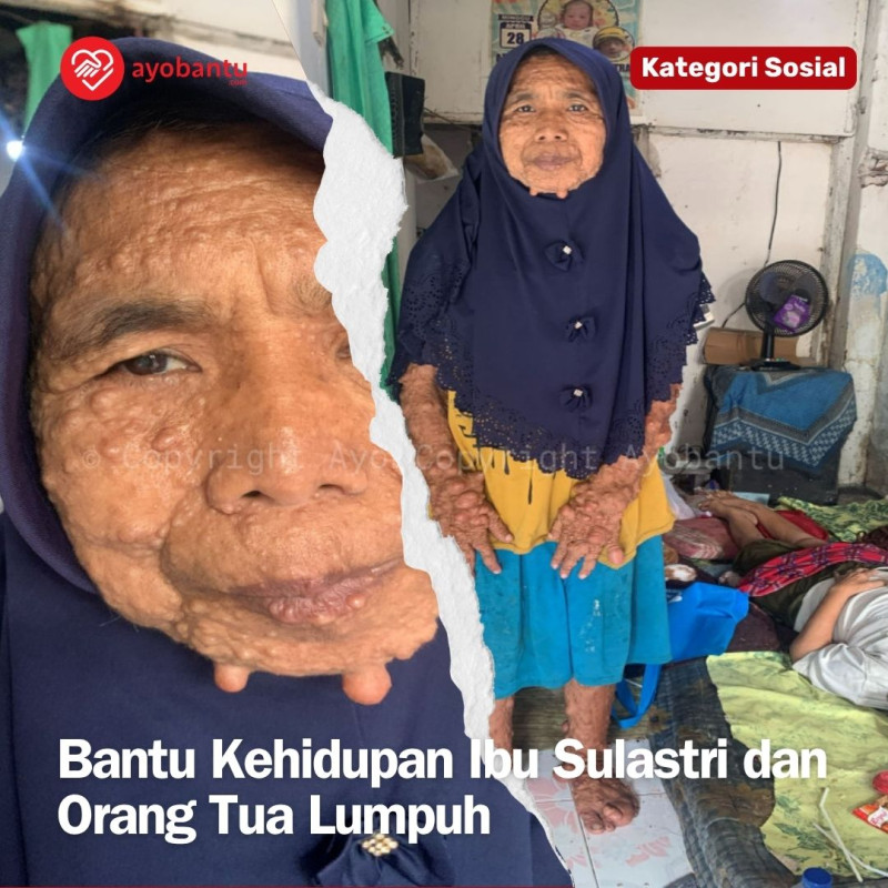 Bantu Kehidupan Ibu Sulastri dan Orang Tua Lumpuh